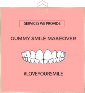 Gummy Smile Makeover - Harley St Smile