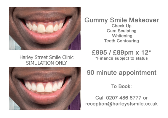 Transform Your Smile Makeover with Gum Contouring